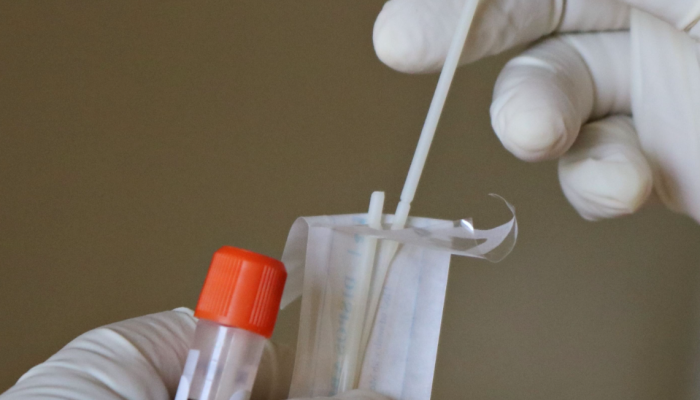Terjawab! Inilah Hasil Tes DNA Habib Bahar Bin Smith